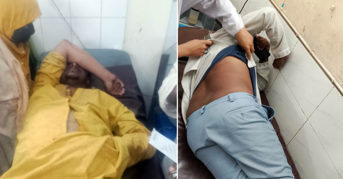 নারায়ণগঞ্জে জামায়াতের গণসংযোগে হামলা, আহত ৪